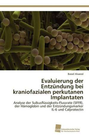 Evaluierung Der Entzundung Bei Kraniofazialen Perkutanen Implantaten: Finding Out about Getting in de Bassel Alsaeed