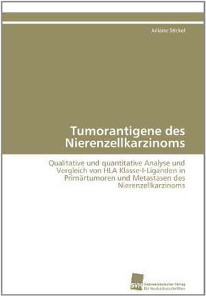 Tumorantigene Des Nierenzellkarzinoms: Ein Zytokin Der Il-10-Interferon-Familie de Juliane Stickel