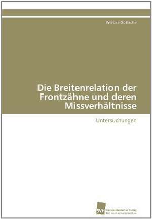 Die Breitenrelation Der Frontzahne Und Deren Missverhaltnisse: Ein Zytokin Der Il-10-Interferon-Familie de Wiebke Göttsche