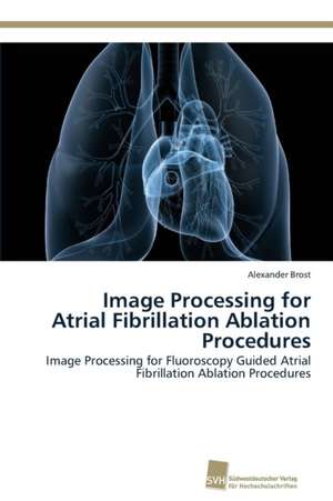 Image Processing for Atrial Fibrillation Ablation Procedures de Alexander Brost