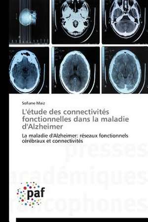 L'étude des connectivités fonctionnelles dans la maladie d'Alzheimer de Sofiane Maiz