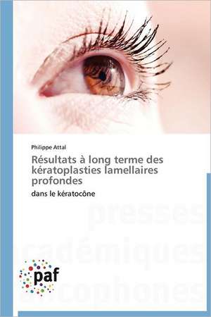 Résultats à long terme des kératoplasties lamellaires profondes de Philippe Attal