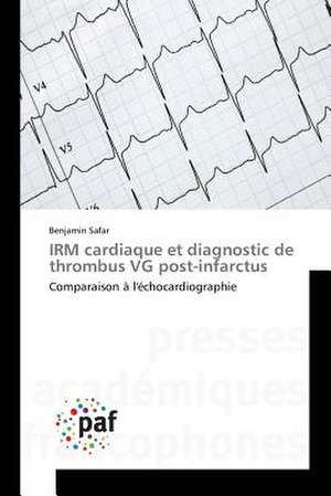 IRM cardiaque et diagnostic de thrombus VG post-infarctus de Benjamin Safar