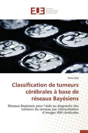 Classification de Tumeurs Cerebrales a Base de Reseaux Bayesiens: Codage Et Simulation de Asma Daly