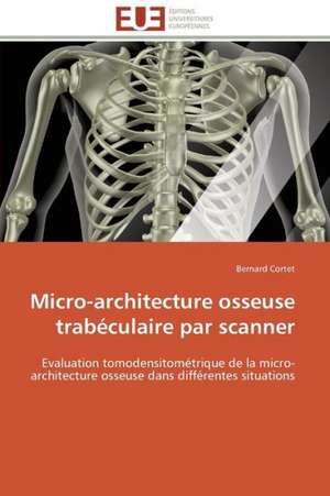 Micro-Architecture Osseuse Trabeculaire Par Scanner: Application Au Maghreb de Bernard Cortet