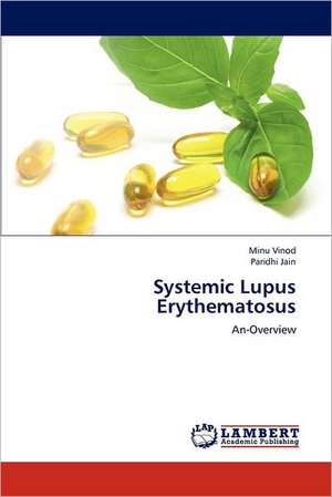 Systemic Lupus Erythematosus de Minu Vinod