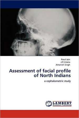 Assessment of facial profile of North Indians de Parul Jain