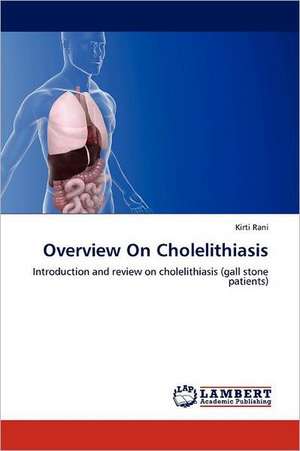 Overview On Cholelithiasis de Kirti Rani