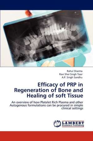 Efficacy of PRP in Regeneration of Bone and Healing of soft Tissue de Rahul Sharma