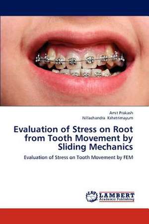 Evaluation of Stress on Root from Tooth Movement by Sliding Mechanics de Amit Prakash