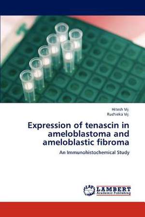 Expression of tenascin in ameloblastoma and ameloblastic fibroma de Hitesh Vij