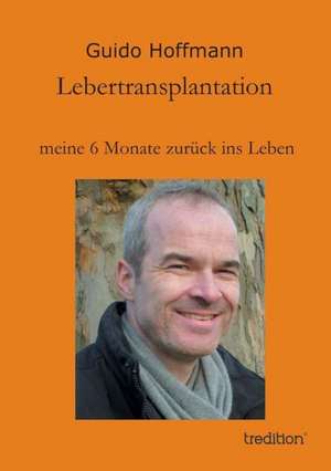 Lebertransplantation Meine 6 Monate Zuruck Ins Leben: Manipulation de Guido Hoffmann