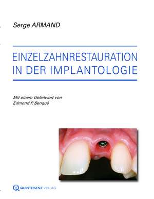 Einzelzahnrestaurationen in der Implantologie de Serge Armand