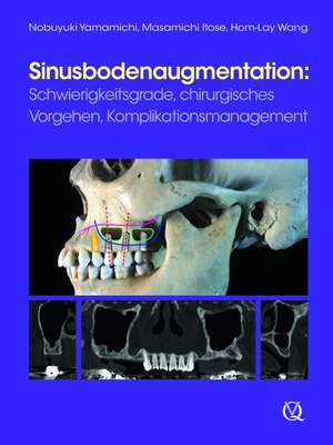 Sinusbodenaugmentation de Nobuyuki Yamamichi