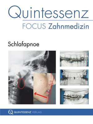 Quintessenz Focus Zahnmedizin: Schlafapnoe de Jürgen Langenhan