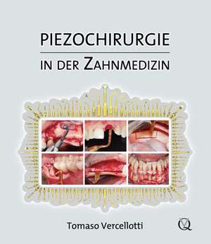 Piezochirurgie in der Zahnmedizin de Tomaso Vercellotti