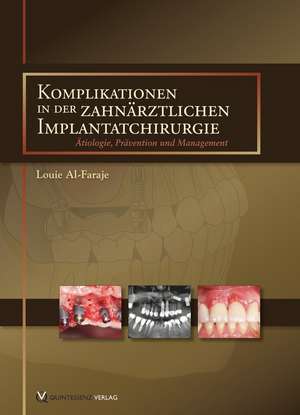 Komplikationen in der zahnärztlichen Implantatchirurgie: Ätiologie, Prävention und Management de Louie Al-Faraje