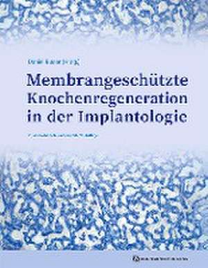 Membrangeschützte Knochenregeneration in der Implantologie de Daniel Buser