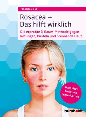 Rosacea - Das hilft wirklich de Franziska Ring