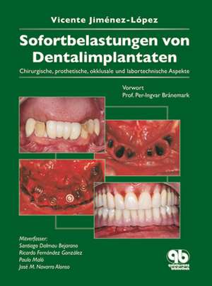 Sofortbelastung von Dentalimplantaten: Chirurgische, prothetische, okklusale und labortechnische Aspekte de Vicente Jiménez-López