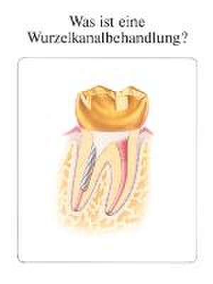 Was ist eine Wurzelkanalbehandlung? de Joel M Berns