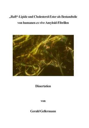 Raft -Lipide und Cholesterol-Ester als Bestandteile von humanen ex vivo Amyloid-Fibrillen de Gerald Gellermann