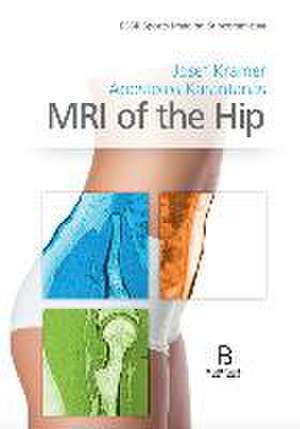 MRI of the Hip de Apostels Karantanas