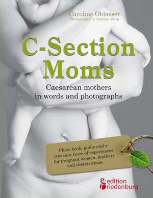 C-Section Moms - Caesarean mothers in words and photographs de Caroline Oblasser