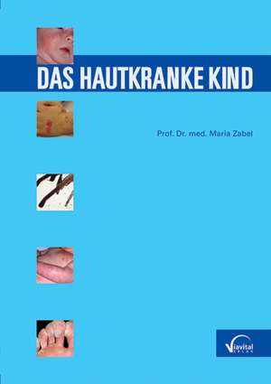 Das hautkranke Kind de Maria Zabel