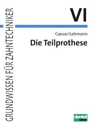 Die Teilprothese de Hans H. Caesar