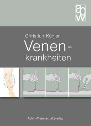 Venenkrankheiten de Christian Kügler