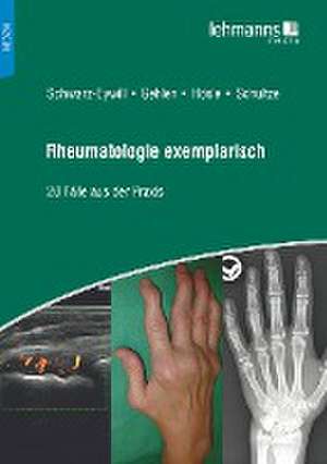 Rheumatologie exemplarisch de Michael Schwarz-Eywill