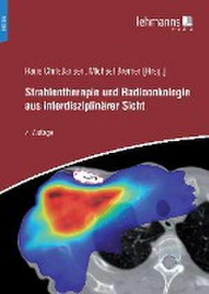 Strahlentherapie und Radioonkologie aus interdisziplinärer Sicht de Hans Christiansen