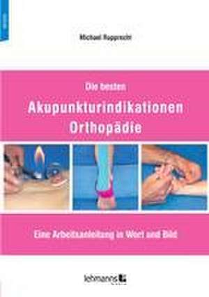 Die besten Akupunkturindikationen Orthopädie de Michael Rupprecht