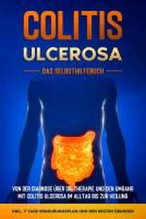 Colitis ulcerosa - Das Selbsthilfebuch: Von der Diagnose über die Therapie und den Umgang mit Colitis ulcerosa im Alltag bis zur Heilung - inkl. 7-Tage-Ernährungsplan und den besten Übungen de Maria Baumfink