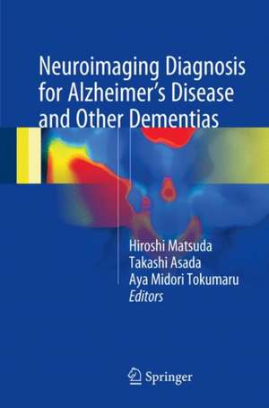 Neuroimaging Diagnosis for Alzheimer's Disease and Other Dementias de Hiroshi Matsuda