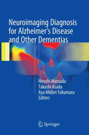 Neuroimaging Diagnosis for Alzheimer's Disease and Other Dementias de Hiroshi Matsuda