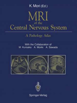 MRI of the Central Nervous System: A Pathology Atlas de M. Kurisaka