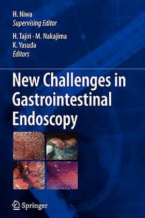 New Challenges in Gastrointestinal Endoscopy de Hirohumi Niwa