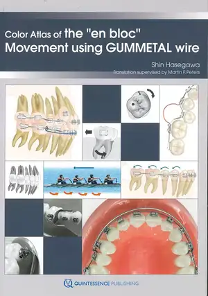 Color Atlas of the 'en bloc' Movement Using GUMMETAL wire de Shin Hasegawa