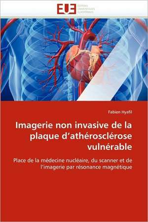 Imagerie Non Invasive de La Plaque D''Atherosclerose Vulnerable: Integration Et/Ou Assimilation? de Fabien Hyafil