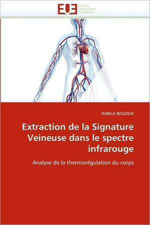 Extraction de La Signature Veineuse Dans Le Spectre Infrarouge: Bois / Bio-Polymere de NABILA BOUZIDA