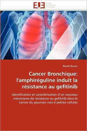 Cancer Bronchique: L'Amphireguline Induit La Resistance Au Gefitinib de Benoit Busser