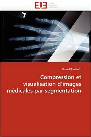 Compression Et Visualisation D Images Medicales Par Segmentation: Le Match de Qosai KANAFANI