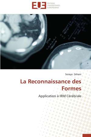 La Reconnaissance Des Formes