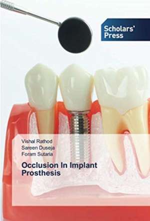 Occlusion In Implant Prosthesis de Vishal Rathod