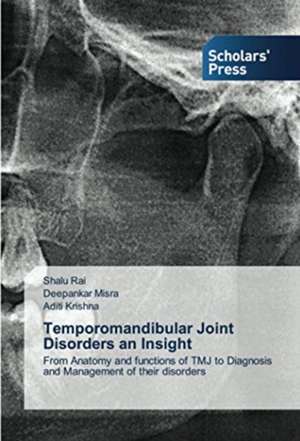 Temporomandibular Joint Disorders an Insight de Shalu Rai