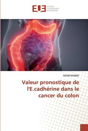 Valeur pronostique de l'E.cadhérine dans le cancer du colon de Issam Msakni