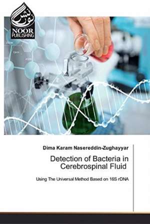 Detection of Bacteria in Cerebrospinal Fluid de Dima Karam Nasereddin-Zughayyar