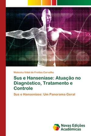 Sus e Hanseníase: Atuação no Diagnóstico, Tratamento e Controle de Waleska Vidal de Freitas Carvalho